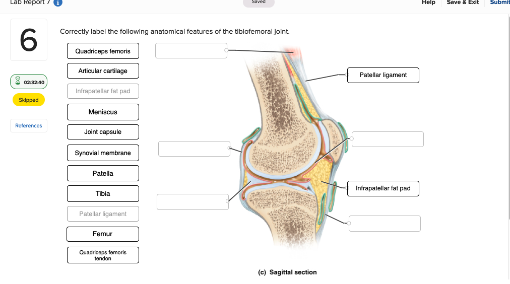 Learn to Correctly Label the Following Anatomical Features of the Tibiofemoral Joint with Ease.