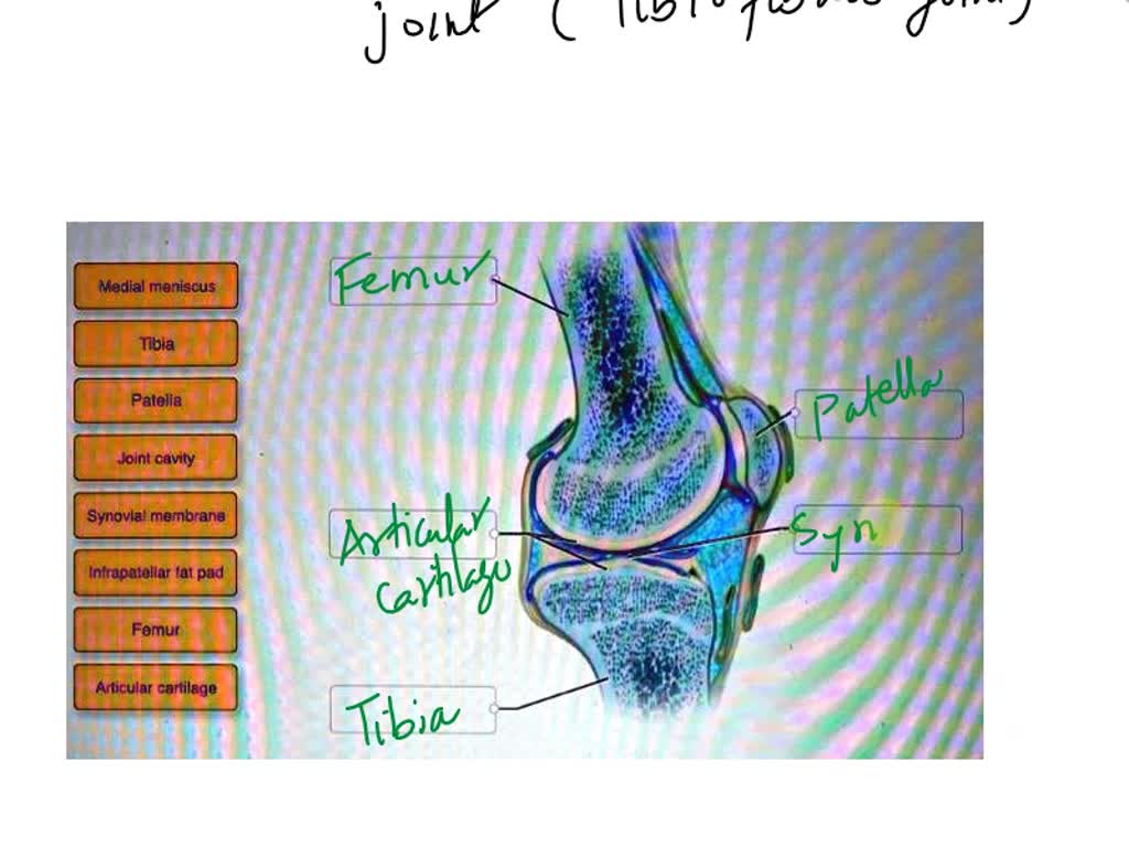 Easy Guide: Correctly Label the Anatomical Features of the Tibiofemoral Joint