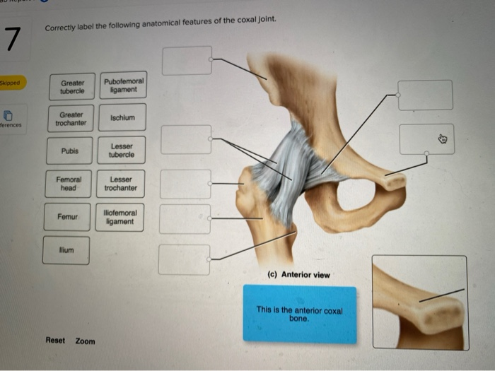 How to Correctly Label the Following Anatomical Features of the Coxal Joint? A Simple Guide