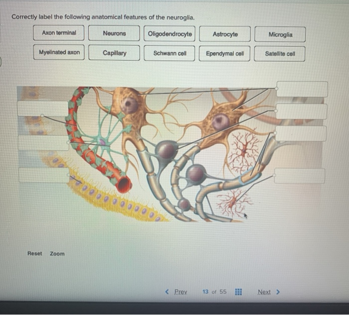 Unlocking Neuroglia:  Tips and Tricks to Correctly Label the Following Anatomical Features