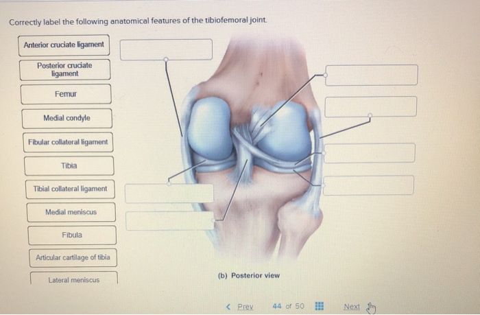 Easy Guide: Correctly Label the Anatomical Features of the Tibiofemoral Joint