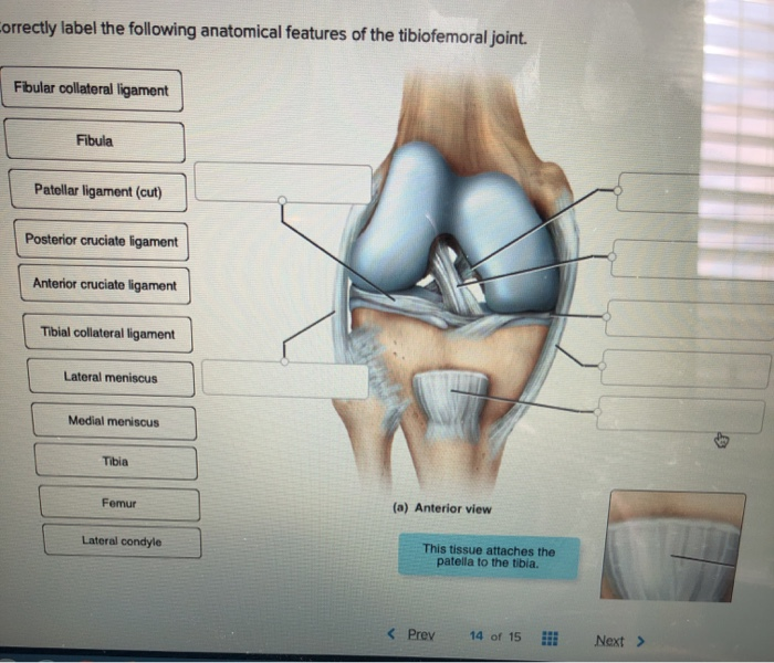 Easy Guide: Correctly Label the Anatomical Features of the Tibiofemoral Joint